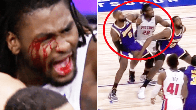 NOVI OBRAČUN U NBA: Namjeran udarac, krv i jurnjava obilježili su utakmicu Detroit – LA Lejkers