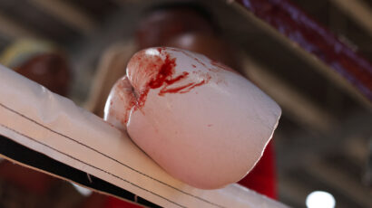 BRAZILSKI BOKSER PREMINUO OD POSLEDICA NOKAUTA: Borio se u meču vrijednom oko 28 eura!