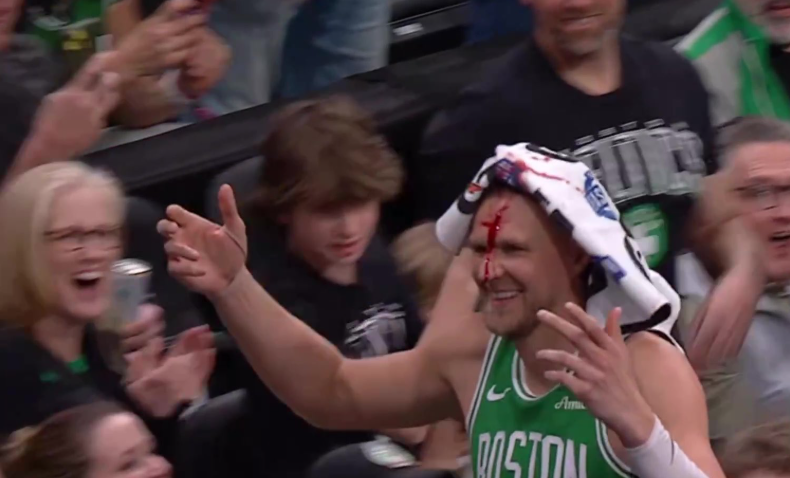 Džo Macula: Volim kad Porzingis krvari na parketu