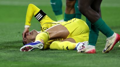 Ronaldova povreda gora nego što se prognoziralo